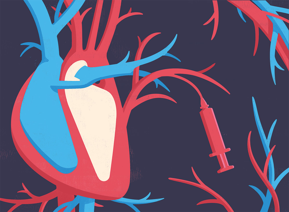 heart illustration with syringe connected to blood vessel