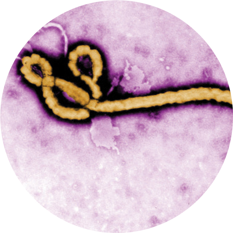 ebola closeup microscopic view
